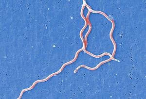 Borreila burgdorferi bacteria